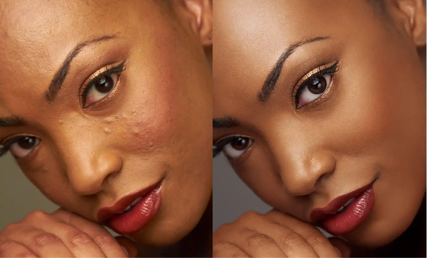 You are exposed to unrealistic media portrayals leading to negative body image
